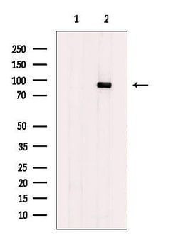 Invitrogen CPT1A Polyclonal Antibody 100 &mu;L; Unconjugated:Antibodies,
