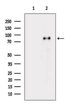Invitrogen CPT1A Polyclonal Antibody 100 &mu;L; Unconjugated:Antibodies,
