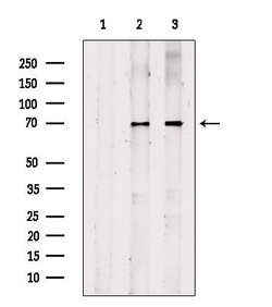 Invitrogen CPT1A Polyclonal Antibody 100 &mu;L; Unconjugated:Antibodies,