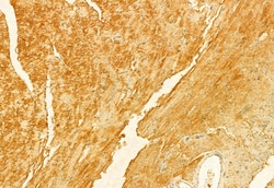 Invitrogen FIS1 Polyclonal Antibody 100 &mu;L; Unconjugated:Antibodies,