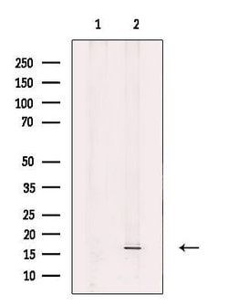 Invitrogen FIS1 Polyclonal Antibody 100 &mu;L; Unconjugated:Antibodies,