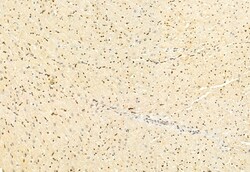 Invitrogen DACH1 Polyclonal Antibody 100 μL; Unconjugated:Antibodies,