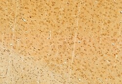 Invitrogen DACH1 Polyclonal Antibody 100 μL; Unconjugated:Antibodies,