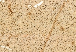 Invitrogen DACH1 Polyclonal Antibody 100 μL; Unconjugated:Antibodies,
