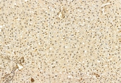 Invitrogen DACH1 Polyclonal Antibody 100 μL; Unconjugated:Antibodies,