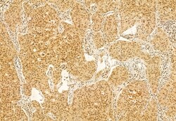 Invitrogen DACH1 Polyclonal Antibody 100 μL; Unconjugated:Antibodies,