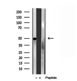 Invitrogen PADI2 Polyclonal Antibody 100 &mu;L; Unconjugated:Antibodies,