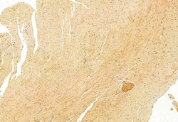 Invitrogen IFT81 Polyclonal Antibody 100 μL; Unconjugated:Antibodies,