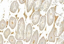 Invitrogen IFT81 Polyclonal Antibody 100 μL; Unconjugated:Antibodies,