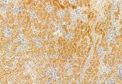 Invitrogen IFT81 Polyclonal Antibody 100 μL; Unconjugated:Antibodies,