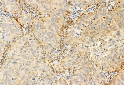 Invitrogen IFT81 Polyclonal Antibody 100 μL; Unconjugated:Antibodies,