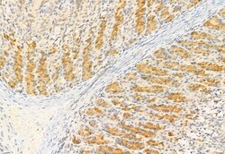 Invitrogen IFT81 Polyclonal Antibody 100 μL; Unconjugated:Antibodies,