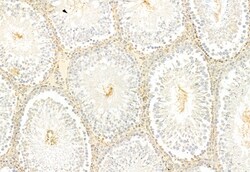 Invitrogen IFT81 Polyclonal Antibody 100 μL; Unconjugated:Antibodies,