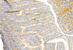Invitrogen IFT81 Polyclonal Antibody 100 μL; Unconjugated:Antibodies,