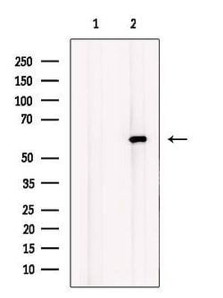 LPCAT1 Polyclonal Antibody:Antibodies, Polyclonal