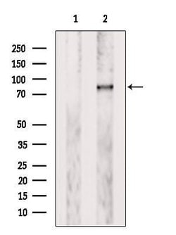 Invitrogen PLOD3 Polyclonal Antibody 100 &mu;L | Buy Online | Invitrogen&trade; | Fisher Scientific