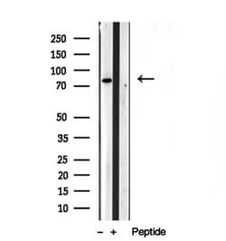 Invitrogen PLOD3 Polyclonal Antibody 100 &mu;L | Buy Online | Invitrogen&trade; | Fisher Scientific