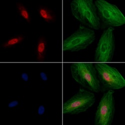 Invitrogen SGTA Polyclonal Antibody 100 μL; Unconjugated:Antibodies,