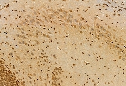 Invitrogen S100A14 Polyclonal Antibody 100 &mu;L; Unconjugated:Antibodies,
