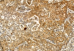Invitrogen S100A14 Polyclonal Antibody 100 &mu;L; Unconjugated:Antibodies,