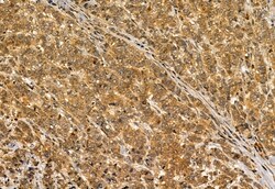 Invitrogen S100A14 Polyclonal Antibody 100 &mu;L; Unconjugated:Antibodies,