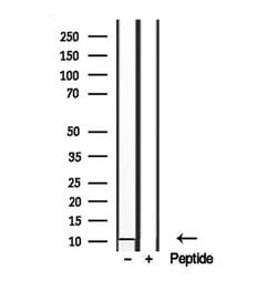 Invitrogen S100A14 Polyclonal Antibody 100 &mu;L; Unconjugated:Antibodies,