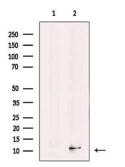 Invitrogen S100A14 Polyclonal Antibody 100 &mu;L; Unconjugated:Antibodies,