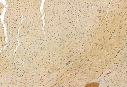HIPPI Polyclonal Antibody, Invitrogen 100 &mu;L; Unconjugated:Antibodies,