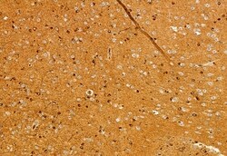 Invitrogen PPP1R15B Polyclonal Antibody 100 &mu;L; Unconjugated:Antibodies,