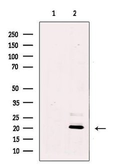 Invitrogen REEP5 Polyclonal Antibody 100 μL; Unconjugated:Antibodies,