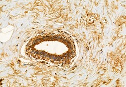 Invitrogen CHKA Polyclonal Antibody 100 &mu;L; Unconjugated:Antibodies,