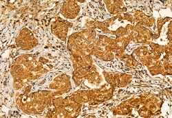 Invitrogen CHKA Polyclonal Antibody 100 &mu;L; Unconjugated:Antibodies,