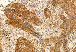 Invitrogen CHKA Polyclonal Antibody 100 &mu;L; Unconjugated:Antibodies,