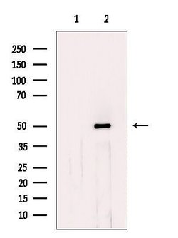Invitrogen CHKA Polyclonal Antibody 100 &mu;L; Unconjugated:Antibodies,