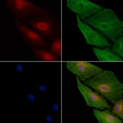 Invitrogen COMMD1 Polyclonal Antibody 100 μL; Unconjugated:Antibodies,