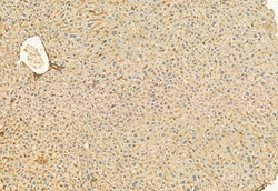 Invitrogen COMMD1 Polyclonal Antibody 100 μL; Unconjugated:Antibodies,