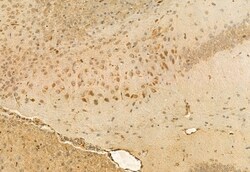 Invitrogen COMMD1 Polyclonal Antibody 100 μL; Unconjugated:Antibodies,