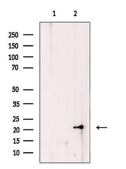 Invitrogen COMMD1 Polyclonal Antibody 100 μL; Unconjugated:Antibodies,
