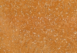 DHRS3 Polyclonal Antibody:Antibodies, Polyclonal
