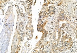 DHRS3 Polyclonal Antibody:Antibodies, Polyclonal