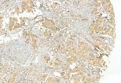 DHRS3 Polyclonal Antibody:Antibodies, Polyclonal
