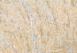 DHRS3 Polyclonal Antibody:Antibodies, Polyclonal