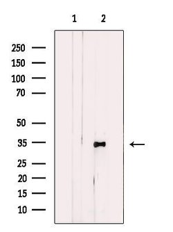 DHRS3 Polyclonal Antibody:Antibodies, Polyclonal