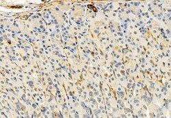 Invitrogen FKBP10 Polyclonal Antibody 100 &mu;L; Unconjugated:Antibodies,