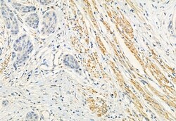 Invitrogen FKBP10 Polyclonal Antibody 100 &mu;L; Unconjugated:Antibodies,