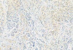 Invitrogen FKBP10 Polyclonal Antibody 100 &mu;L; Unconjugated:Antibodies,