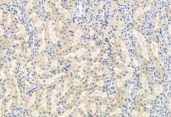 Invitrogen FKBP10 Polyclonal Antibody 100 &mu;L; Unconjugated:Antibodies,