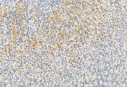 Invitrogen FKBP10 Polyclonal Antibody 100 &mu;L; Unconjugated:Antibodies,