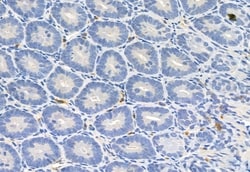 Invitrogen FKBP10 Polyclonal Antibody 100 &mu;L; Unconjugated:Antibodies,