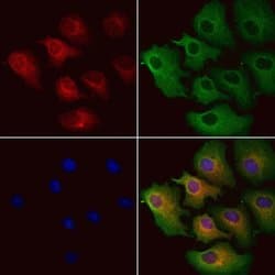 Invitrogen MCD Polyclonal Antibody 100 &mu;L; Unconjugated:Antibodies,
